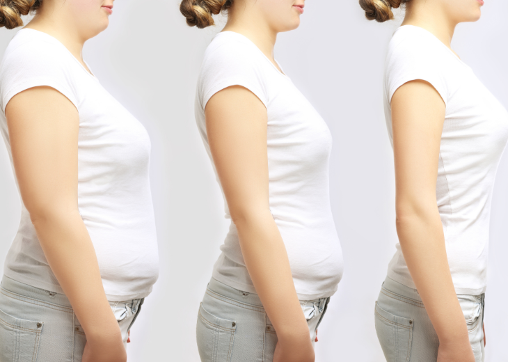 Top weight loss surgeon in Surat