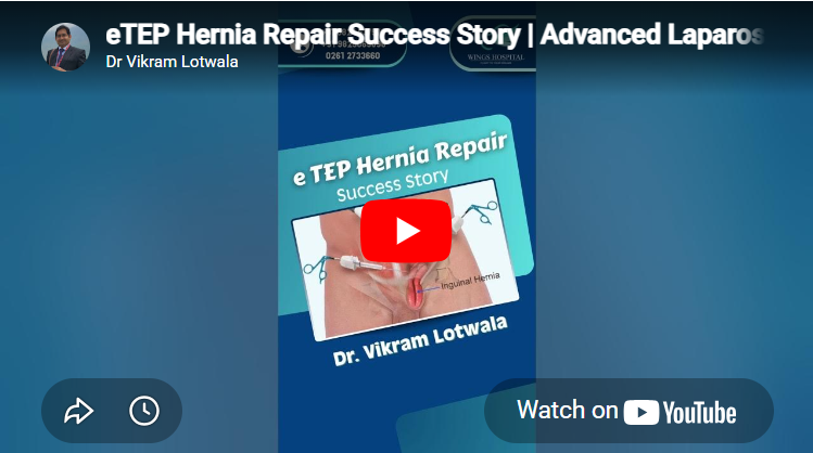 Advanced Laparoscopic Surgery by Dr. Vikram Lotwala