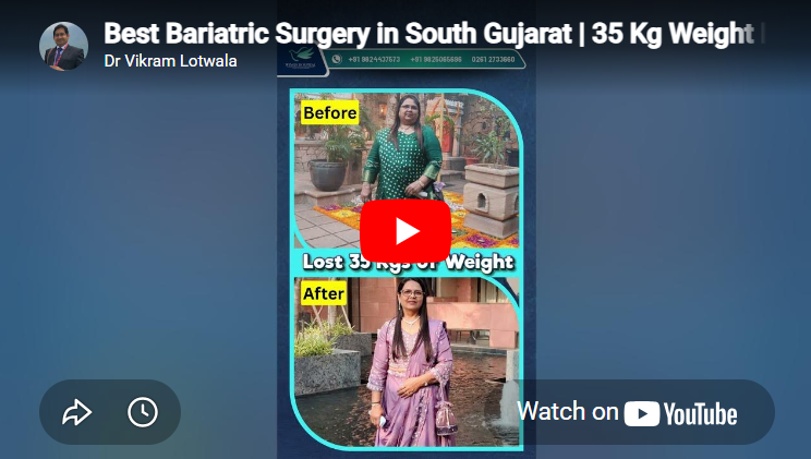 Best Bariatric Surgery in South Gujarat
