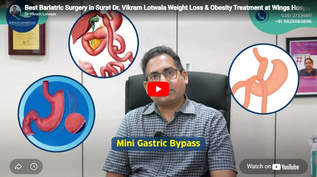 Best Bariatric Surgery in Surat Dr. Vikram Lotwala Weight Loss & Obesity Treatment at Wings Hospital