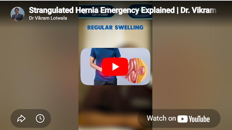 Best Hernia Surgeon in Surat